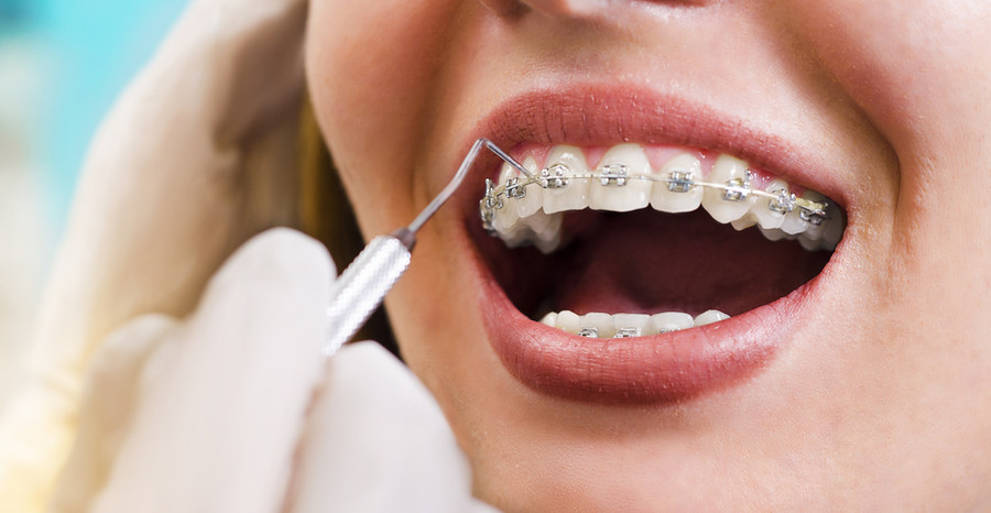 Ortodontik Tedavinin Başarısında Hastaların Sorumlulukları